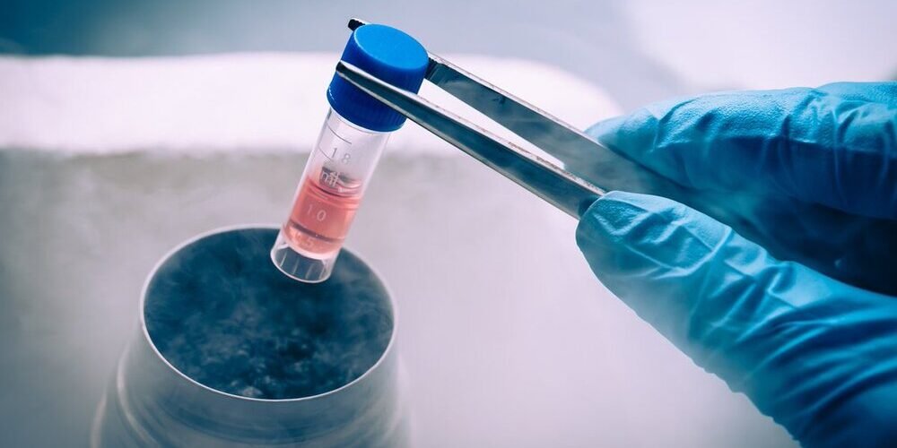 Fertility Preserving Treatments In Pune