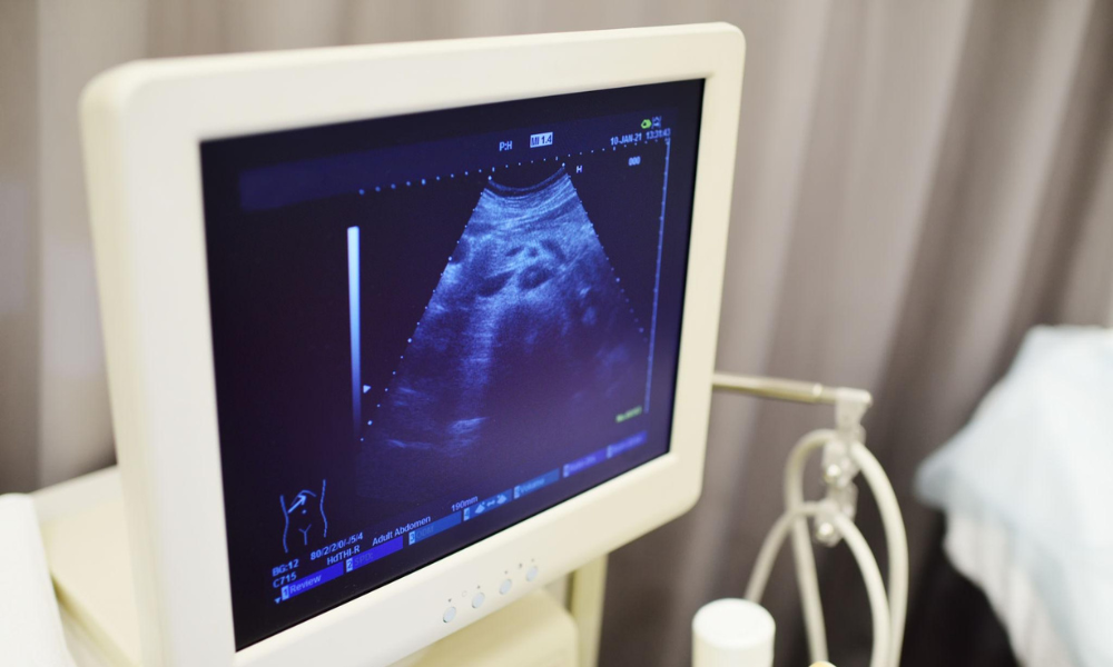 Male Infertility Evaluation In Pune