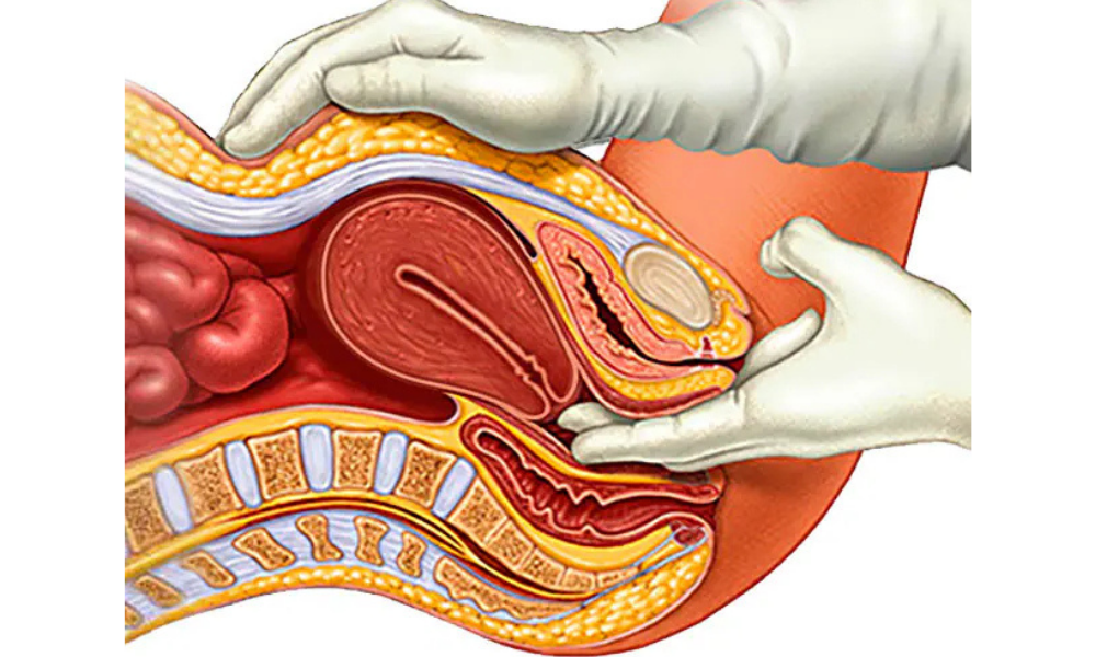 PCOS/PCOD Management In Pune